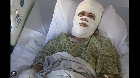 Savannah Authorities Hunt Suspect in Random Chemical Attack on Local Woman