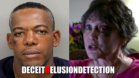 An 84-year-old white woman who was sucker punched during a robbery by a black male suspect shares her story
