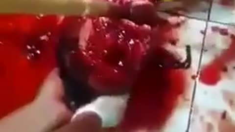 WATCH BEFORE ITS DELETED