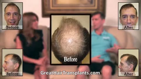Dr. Brett Bolton Delivers Remarkable Corrective Hair Transplant Results