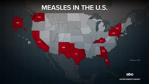 CDC reporting measles cases in at least a dozen states