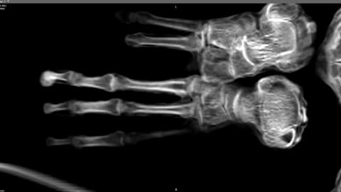 🩺👽 Maria's Tridactyl Features Confirmed Authentic | TheTruthAbove
