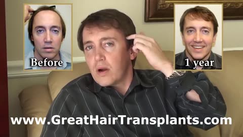Unbelievable Birth Defect Correction by Dr. Brett Bolton – Hair Transplant Transformation