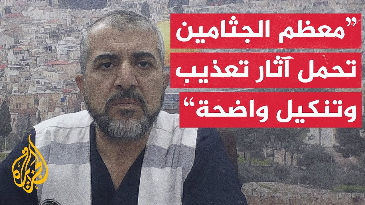 صحة غزة تطالب بفتح تحقيق دولي بعد ظهور أدلة تعذيب على جثامين عدد من الشهداء