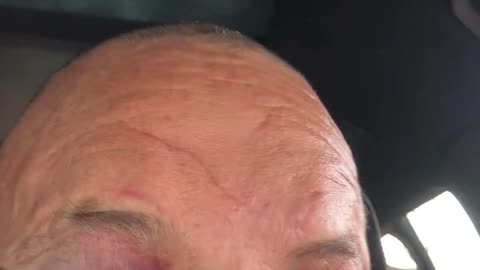 Wanderlei Silva Speaks After Getting Knocked Out in Post-Fight Brawl