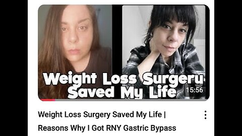 FF 20250710 Weight Loss Surgery Saved My Life Reasons Why I Got RNY Gastric Bypass
