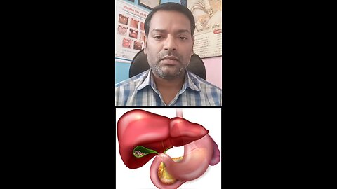 पित्ताशय की पथरी का कब ऑपरेशन करवाना जरूरी होता है ।