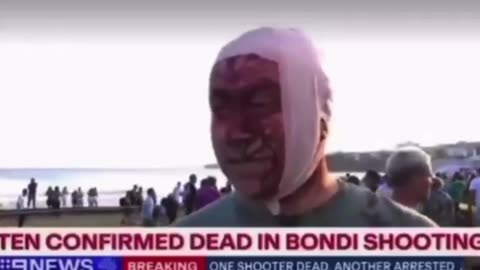 Jewish Zionist Crisis Actor in Australia (Read Description)