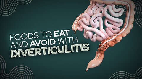 Diverticular Disease Nutrition Dos & Don’ts for Gut Health.#DiverticularDisease #GutHealthTips