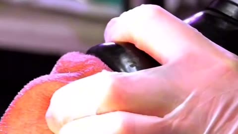 This Is What Happens When Doctors Remove Your Appendix!