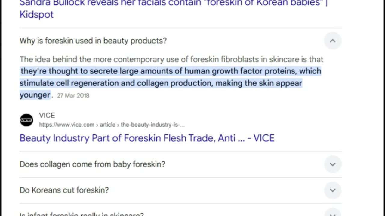 Babies Foreskin - Sandra Bullock - TUC