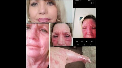 THOUSANDS of Targeted Individuals worldwide