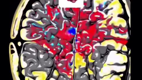 🌀 This sound will reset your brain.