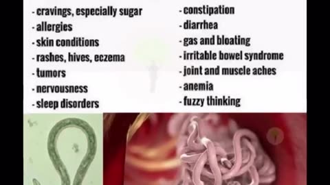 Signs you might have Parasites🤢