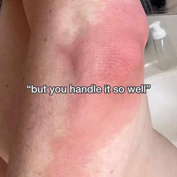 Doing “all the things” wasn’t enough to completely fix my chronic issues…