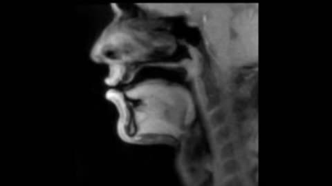 🤯🎙️ This Beatbox Performance Is Happening Inside a Real-Time MRI Scanner! | FeedMyCuriosity