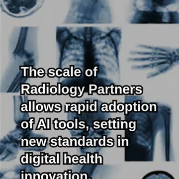 $80 Million Deal Is Reshaping AI in Radiology