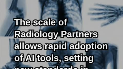 $80 Million Deal Is Reshaping AI in Radiology