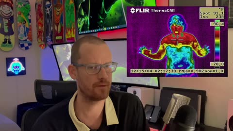 The Surgery that Ruined My Life - ETS Surgery - Sympathectomy