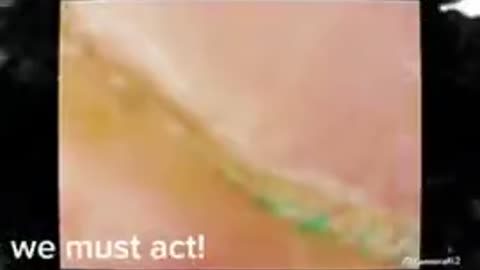 Got it in my Eyes