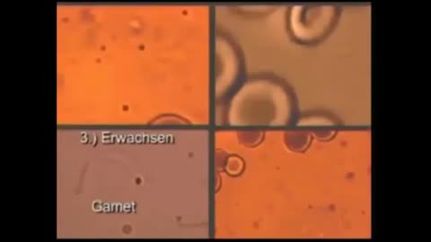 Irrefutable Proof Cancer is Caused by a Parasitic Infection