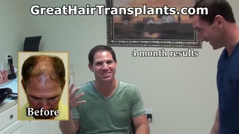 Remarkable Hair Transplant Transformation by Dr. Brett Bolton