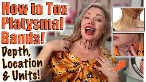 How to Tox your Platysmal Bands! Depth, Location & Units! Code Jessica10 Saves you money