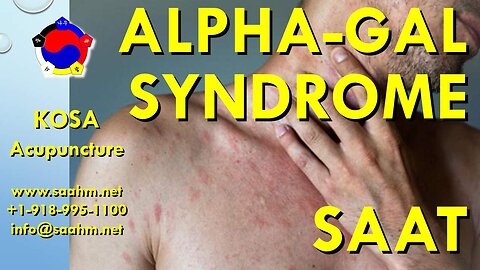 Alpha-Gal Syndrome, Allergies, and SAAT: The Limits of SAAT