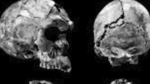 1 Million-Year-Old Skull Discovery Could Rewrite Human Evolution 🧠✨