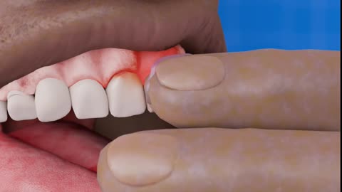 Mouse_Paste_For_Toothaches_