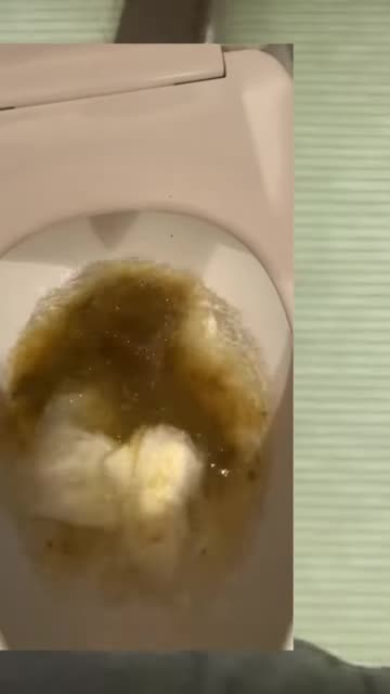 Has Your Poop Looked Like This？ Insomnia Detox Story