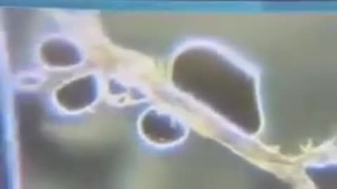 LIPID NANO PARTICLES : MRNA 💉