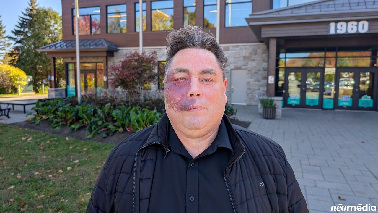 Bruce Gonsalves_2025