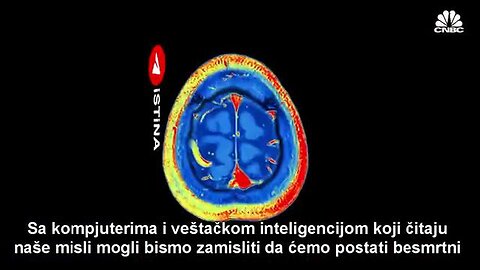 Graphene Brain interface