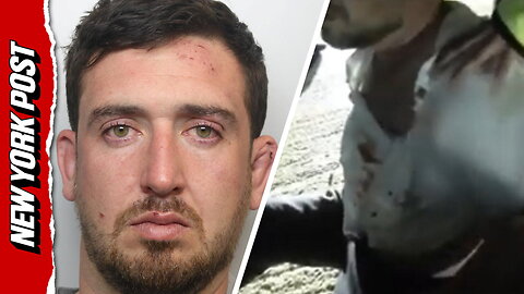 Drunk usher bites off finger of fellow guest at best friend's wedding