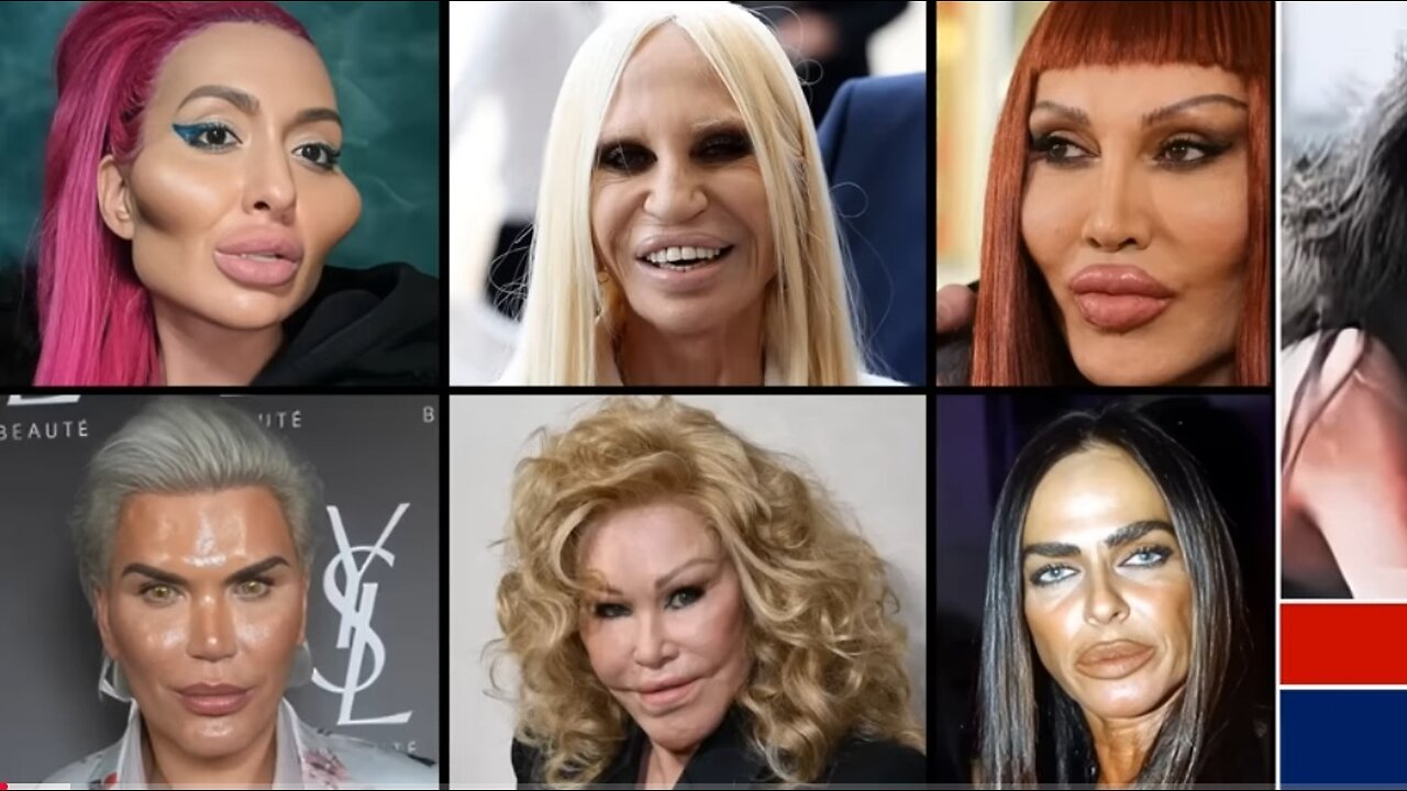 Shocking Celebrity Plastic Surgery Disasters | Before and After