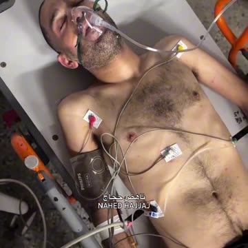 Dr. Mohammad Asaliya is suffering today from convulsions, severe chest pain, and dizziness