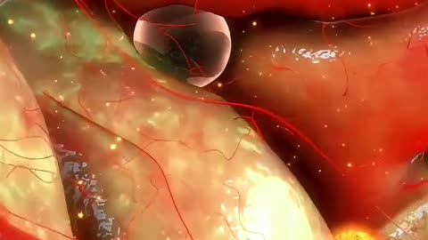 Test Tube Baby (In Vitro Fertilization)