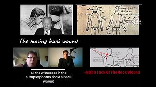 Single Bullshit Theory is DOA bc All Witnesses& Autopsy Photos Show Back Wound-FORD MOVED IT TO NECK