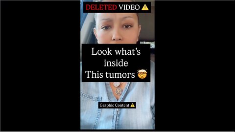 Tumors are Parasites!!!