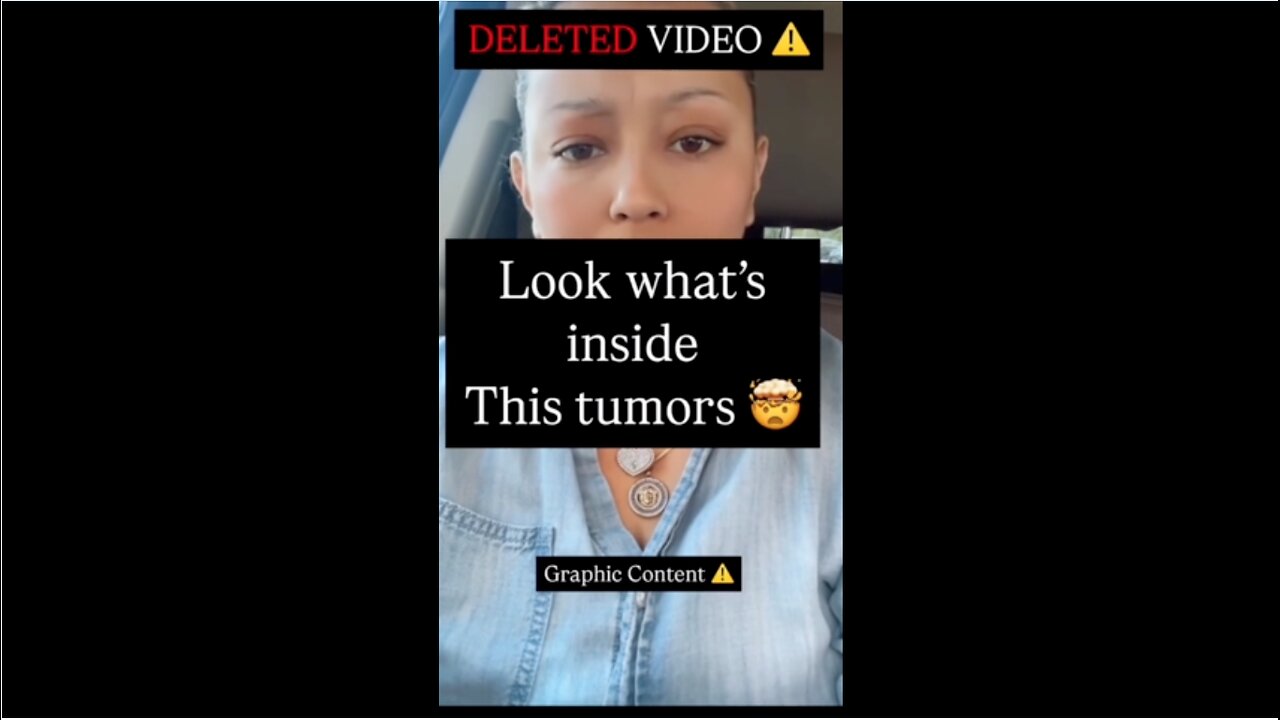 Tumors are Parasites!!!