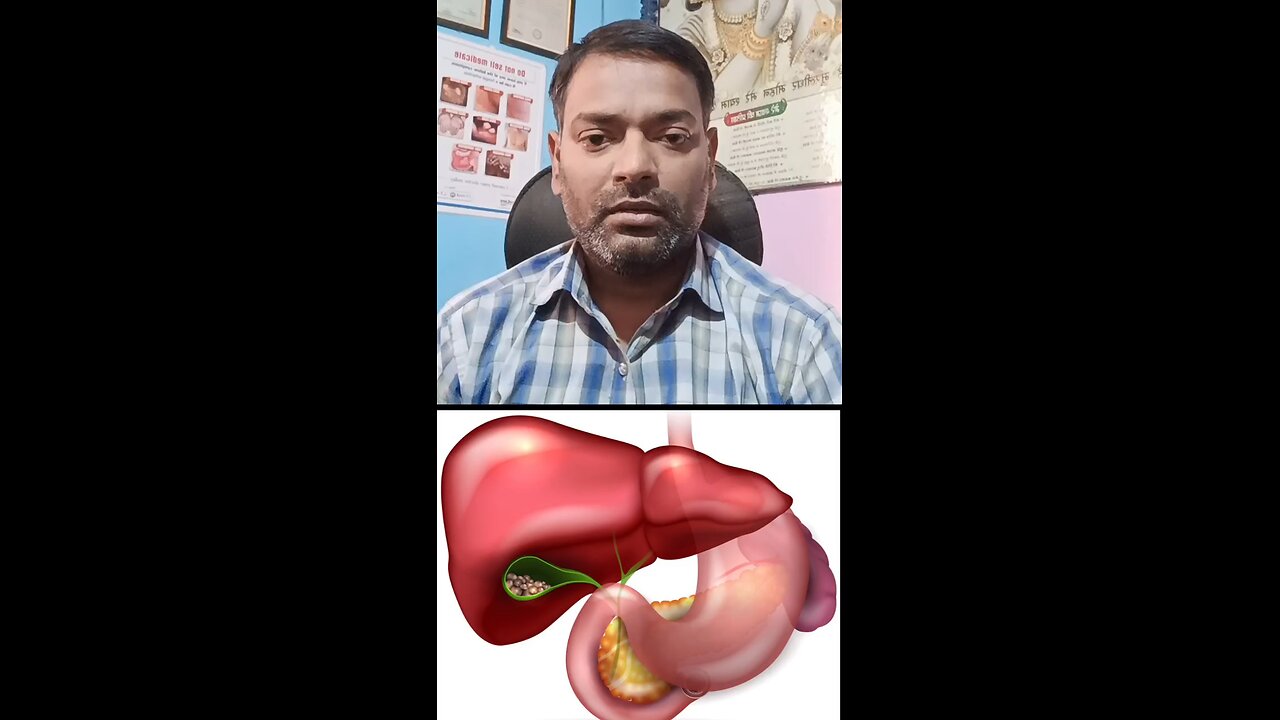 पित्ताशय की पथरी का इलाज ।