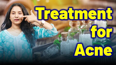 Treatment for Acne ,pimples, Blackheads, Whiteheads. | Treatment Cure Relief Medicine | Homeopathy