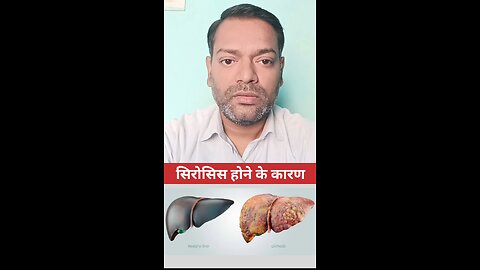 सिरोसिस होने के कारण ।