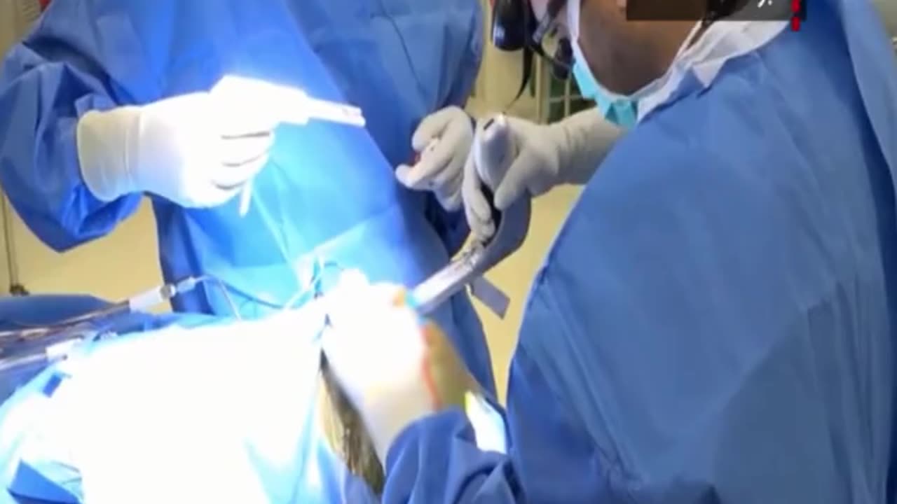 New treatment method for brain cancer cells in Iran