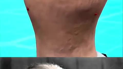 snake bite safety trending video popular video viral 😨😷