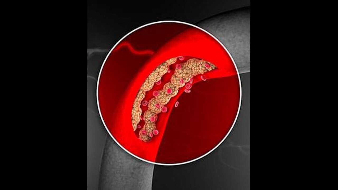 How to treat erectile dysfunction naturally