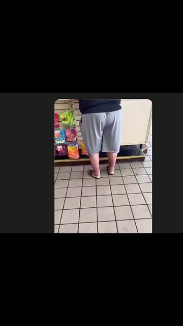 How does this happen? Toezzarella?🍕 He is a walking bio-hazard. 😳😱🤢🤮