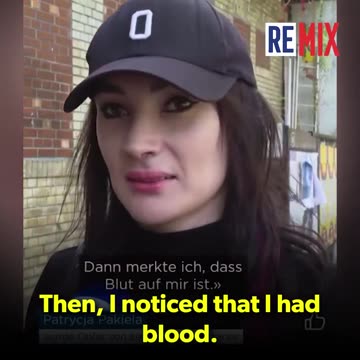 A woman was brutally beaten in a Zurich tram by a bearded man on Sunday