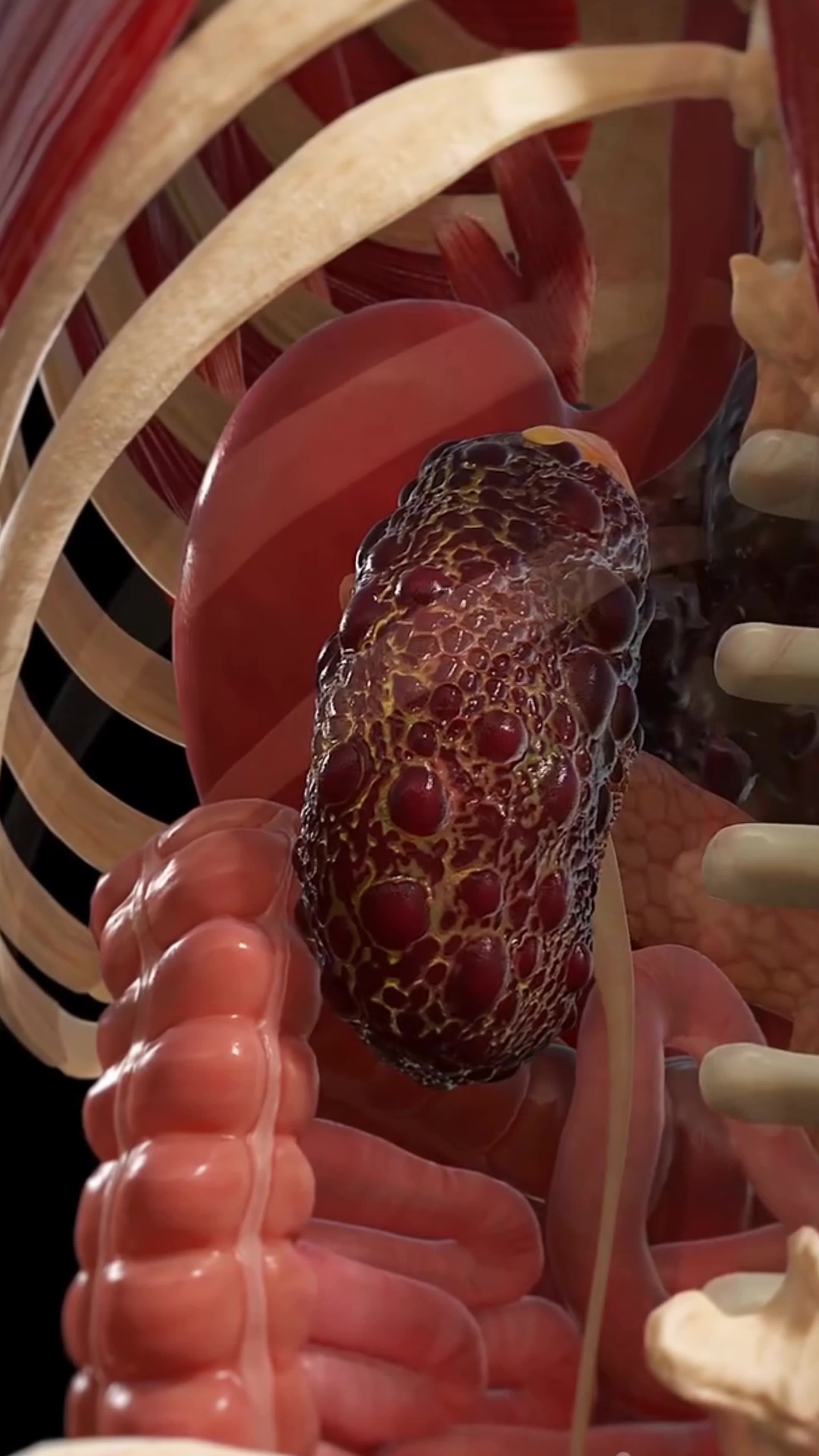 Kidney Miracle: Universal Type O!